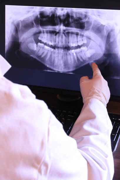 Best Emergency Dental Care for Broken or Chipped Teeth in Loveland, CO